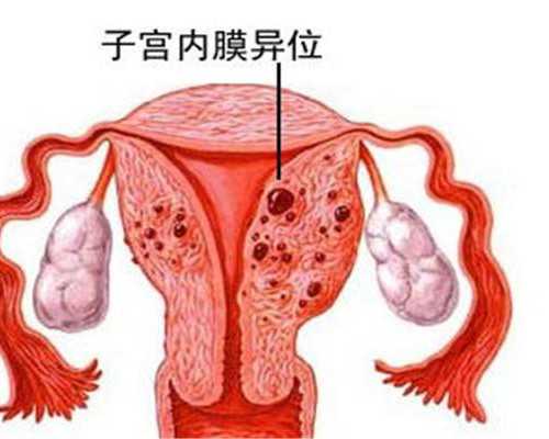 深圳/广州第三代试管婴儿包成功,深圳供卵试管可以包成功吗_杭州哪些医院可以